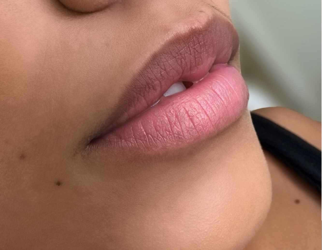 Lips before lip blush treatment