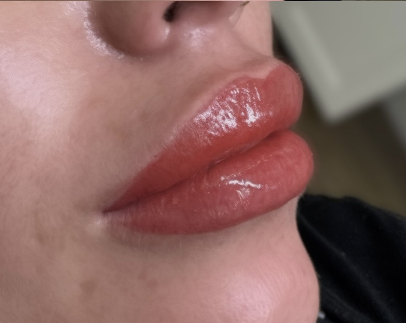 Lips after lip blush appointment at Berkem Brows