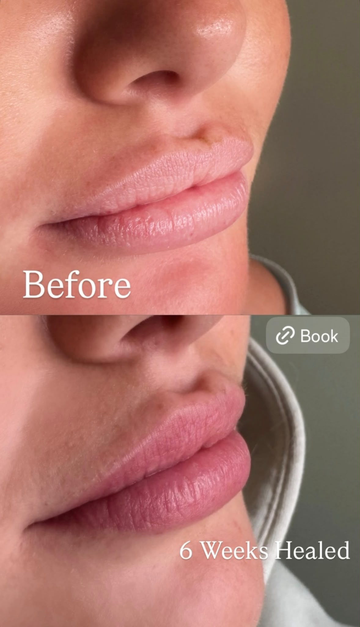 Lip blush before and six weeks healed at Berkem Brows